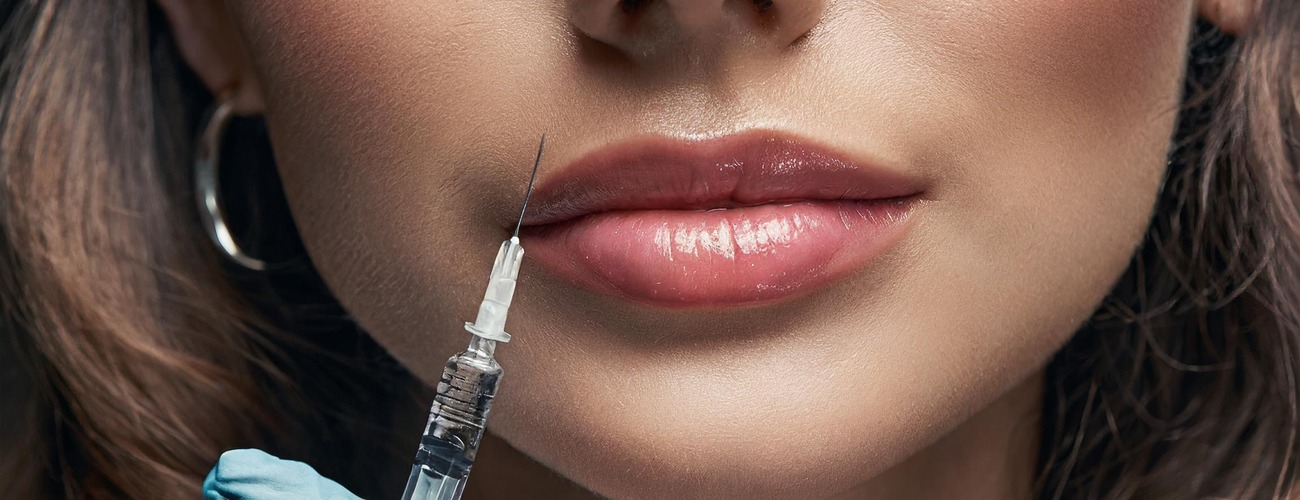 Injections d&rsquo;acide hyaluronique à Lyon : l&rsquo;art de la naturalité et de la restauration des volumes
